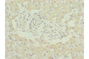 Immunohistochemistry of paraffin-embedded human liver tissue using ABIN7174236 at dilution of 1:100 (MNF1 抗体  (AA 14-126))