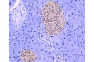 Immunohistochemistry (Paraffin-embedded Sections) (IHC (p)) image for anti-Histone Deacetylase 1 (HDAC1) antibody (ABIN5557476)