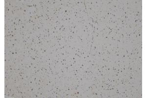 ABIN6275887 at 1/100 staining Human heart tissue by IHC-P. (LHX1 抗体  (Internal Region))