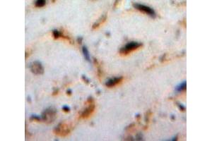 Used in DAB staining on fromalin fixed paraffin-embedded Heart tissue (Cardiotrophin 1 抗体  (AA 1-201))