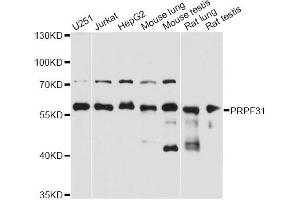 Western blot analysis of extracts of various cell lines, using PRPF31 antibody (ABIN2564749) at 1:3000 dilution. (PRPF31 抗体)