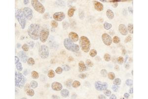 anti-V-Myb Myeloblastosis Viral Oncogene Homolog (Avian) (MYB) (AA 1-50) antibody