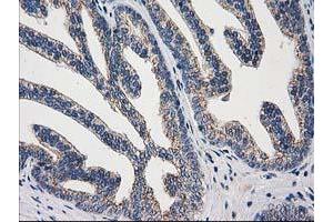 Image no. 7 for anti-ADP-Ribosylation Factor GTPase Activating Protein 1 (ARFGAP1) antibody (ABIN1496679)