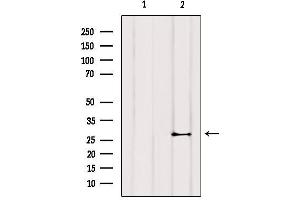 Western blot analysis of extracts from COS-7, using TNNI3 Antibody. (TNNI3 抗体)