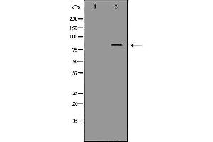 Western Blotting (WB) image for anti-Amyloid beta (A4) Precursor Protein-Binding, Family B, Member 1 (Fe65) (APBB1) (C-Term) antibody (ABIN6259972)