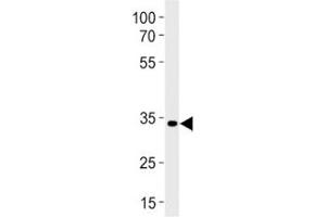 Western Blotting (WB) image for anti-Paired Box Gene 2a (PAX2A) (AA 258-284) antibody (ABIN3029748)