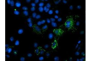 Image no. 11 for anti-Mitochondrial Intermediate Peptidase (MIPEP) (AA 174-516) antibody (ABIN1491016)