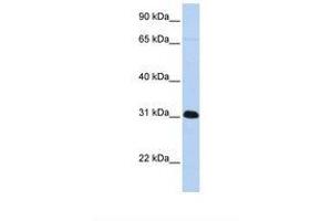 Image no. 1 for anti-Peptidyl Arginine Deiminase, Type IV (PADI4) (AA 398-447) antibody (ABIN6739016)