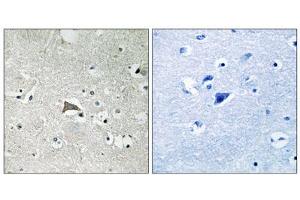 Immunohistochemistry analysis of paraffin-embedded human brain tissue, using VEGFR1 antibody. (FLT1 抗体  (Tyr1048))