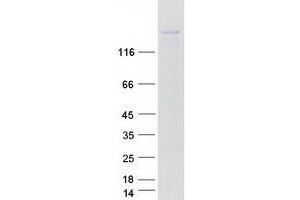 Western Blotting (WB) image for Kinesin Family Member 16B (KIF16B) protein (Myc-DYKDDDDK Tag) (ABIN2724229)