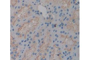Used in DAB staining on fromalin fixed paraffin- embedded kidney tissue (TGOLN2 抗体  (AA 22-323))