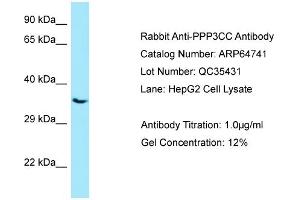 Western Blotting (WB) image for anti-Protein Phosphatase 3, Catalytic Subunit, gamma Isozyme (PPP3CC) (C-Term) antibody (ABIN2789946) (PPP3CC 抗体  (C-Term))