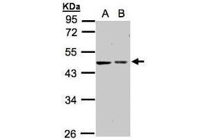 WB Image Sample(30 ug whole cell lysate) A:A431, B:Hep G2 , 10% SDS PAGE antibody diluted at 1:1000 (GALK2 抗体)