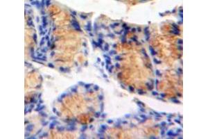 Used in DAB staining on fromalin fixed paraffin-embedded Bowels tissue (MAP4K5 抗体  (AA 9-231))