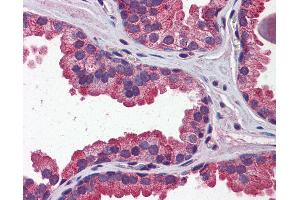 Immunohistochemistry (IHC) image for anti-Wingless-Type MMTV Integration Site Family, Member 3A (WNT3A) (N-Term) antibody (ABIN6747185)
