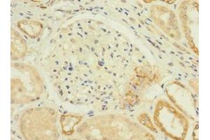 Immunohistochemistry (IHC) image for anti-Calcium Channel, Voltage-Dependent, T Type, alpha 1H Subunit (CACNA1H) (AA 260-360) antibody (ABIN7175612)