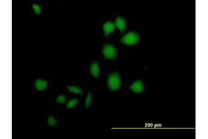 Immunofluorescence of purified MaxPab antibody to DSCR1 on HeLa cell. (RCAN1 抗体  (AA 1-117))