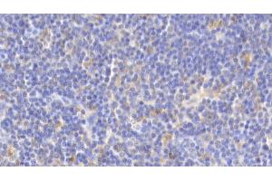 Immunohistochemistry (IHC) image for anti-Interleukin 18 (IL18) (AA 36-192) antibody (ABIN7430729)
