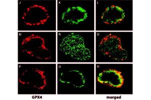 Image no. 2 for anti-Glutathione Peroxidase 4 (GPX4) (N-Term) antibody (ABIN347063) (GPX4 抗体  (N-Term))