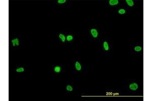 Image no. 3 for anti-RNA Binding Motif Protein, X-Linked-Like 2 (RBMXL2) (AA 1-91) antibody (ABIN599219) (RBMXL2 抗体  (AA 1-91))