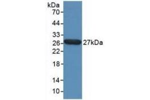 Detection of Recombinant TPT1, Human using Polyclonal Antibody to Tumor Protein, Translationally Controlled 1 (TPT1) (TPT1 抗体  (AA 1-172))