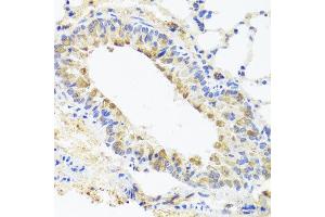 Immunohistochemistry of paraffin-embedded mouse lung using BGLAP antibody at dilution of 1:100 (x40 lens). (Osteocalcin 抗体)