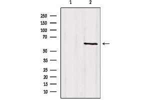 Western blot analysis of extracts from mouse brain, using CLIP3 Antibody. (CLIP3 抗体  (Internal Region))