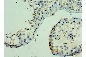 Immunohistochemistry of paraffin-embedded human testis tissue using ABIN7169136 at dilution of 1:100 (PAK6 抗体  (AA 1-270))