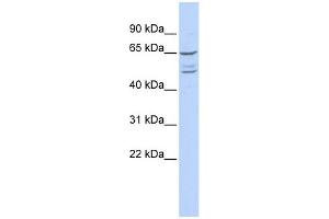 WB Suggested Anti-ZNF415 Antibody Titration:  0. (ZNF415 抗体  (N-Term))