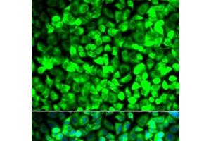 Immunofluorescence analysis of U2OS cells using EIF5 Polyclonal Antibody (EIF5 抗体)