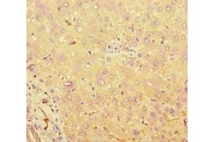 Immunohistochemistry of paraffin-embedded human liver tissue using ABIN7171544 at dilution of 1:100 (TAS2R38 抗体  (AA 212-251))