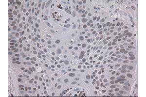 Immunohistochemical staining of paraffin-embedded colon using anti-STAT3 (ABIN2452542) mouse monoclonal antibody. (STAT3 抗体  (AA 154-175))