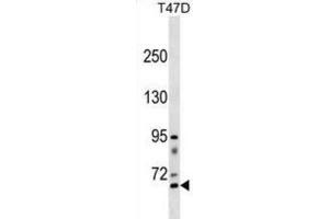 Western Blotting (WB) image for anti-Rhophilin, rho GTPase Binding Protein 2 (RHPN2) antibody (ABIN3000839) (RHPN2 抗体)