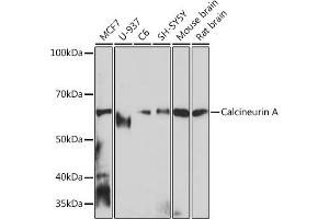 Western blot analysis of extracts of various cell lines, using Calcineurin A Rabbit mAb (ABIN7269692) at 1:1000 dilution. (PPP3CA 抗体)