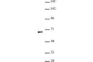 MOF / MYST1 antibody (pAb) tested by Western blot. (MYST1 抗体  (N-Term))