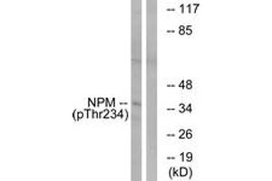Western blot analysis of extracts from HeLa cells treated with nocodazole 1ug/ml 18h, using NPM (Phospho-Thr234) Antibody. (NPM1 抗体  (pThr234))