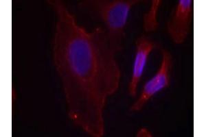 Immunofluorescence staining of methanol-fixed Hela cells using PLCg2(Phospho-Tyr753) Antibody.