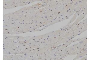 ABIN6274297 at 1/100 staining Mouse heart tissue by IHC-P. (DLX5 抗体  (Internal Region))