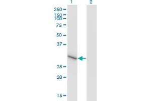 Western Blot analysis of ZNF483 expression in transfected 293T cell line by ZNF483 monoclonal antibody (M01), clone 1E7. (ZNF483 抗体  (AA 142-230))
