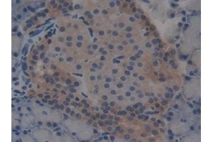 Immunohistochemistry (IHC) image for anti-T-Bet (AA 241-493) antibody (ABIN7442723)