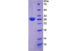 SDS-PAGE of Protein Standard from the Kit (Highly purified E. (Clusterin ELISA 试剂盒)
