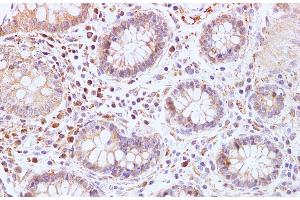 Immunohistochemistry of paraffin-embedded Human colon using BRCA2 Polyclonal Antibody at dilution of 1:100