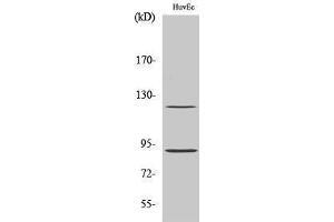 Western Blotting (WB) image for anti-PR (pSer190) antibody (ABIN3172967) (PR (pSer190) 抗体)