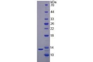 SDS-PAGE of Protein Standard from the Kit (Highly purified E. (IL17F CLIA Kit)