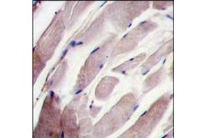 Formalin-fixed and paraffin-embedded human skeletal muscle tissue reacted with the P38 gamma antibody (C-term), which was peroxidase-conjugated to the secondary antibody, followed by DAB staining. (MAPK12 抗体  (C-Term))