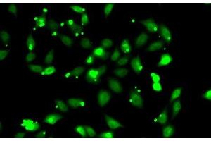 Immunofluorescence analysis of HeLa cells using C1S Polyclonal Antibody (C1S 抗体)
