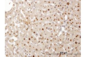 Immunoperoxidase of monoclonal antibody to SMAD6 on formalin-fixed paraffin-embedded human liver. (SMAD6 抗体  (AA 285-384))