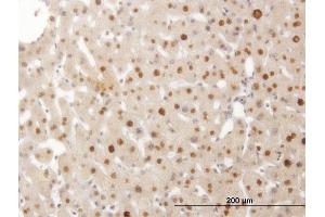 Immunoperoxidase of monoclonal antibody to SMAD6 on formalin-fixed paraffin-embedded human liver.