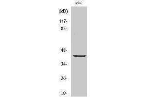 Western Blotting (WB) image for anti-Pyruvate Dehydrogenase (Lipoamide) alpha 1 (PDHA1) (C-Term) antibody (ABIN3186372) (PDHA1 抗体  (C-Term))