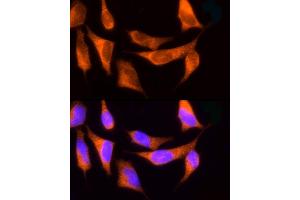 Immunofluorescence analysis of HeLa cells using ROCK2 Rabbit pAb (ABIN6129455, ABIN6147068, ABIN6147069 and ABIN6221359) at dilution of 1:150 (40x lens). (ROCK2 抗体  (AA 1109-1388))